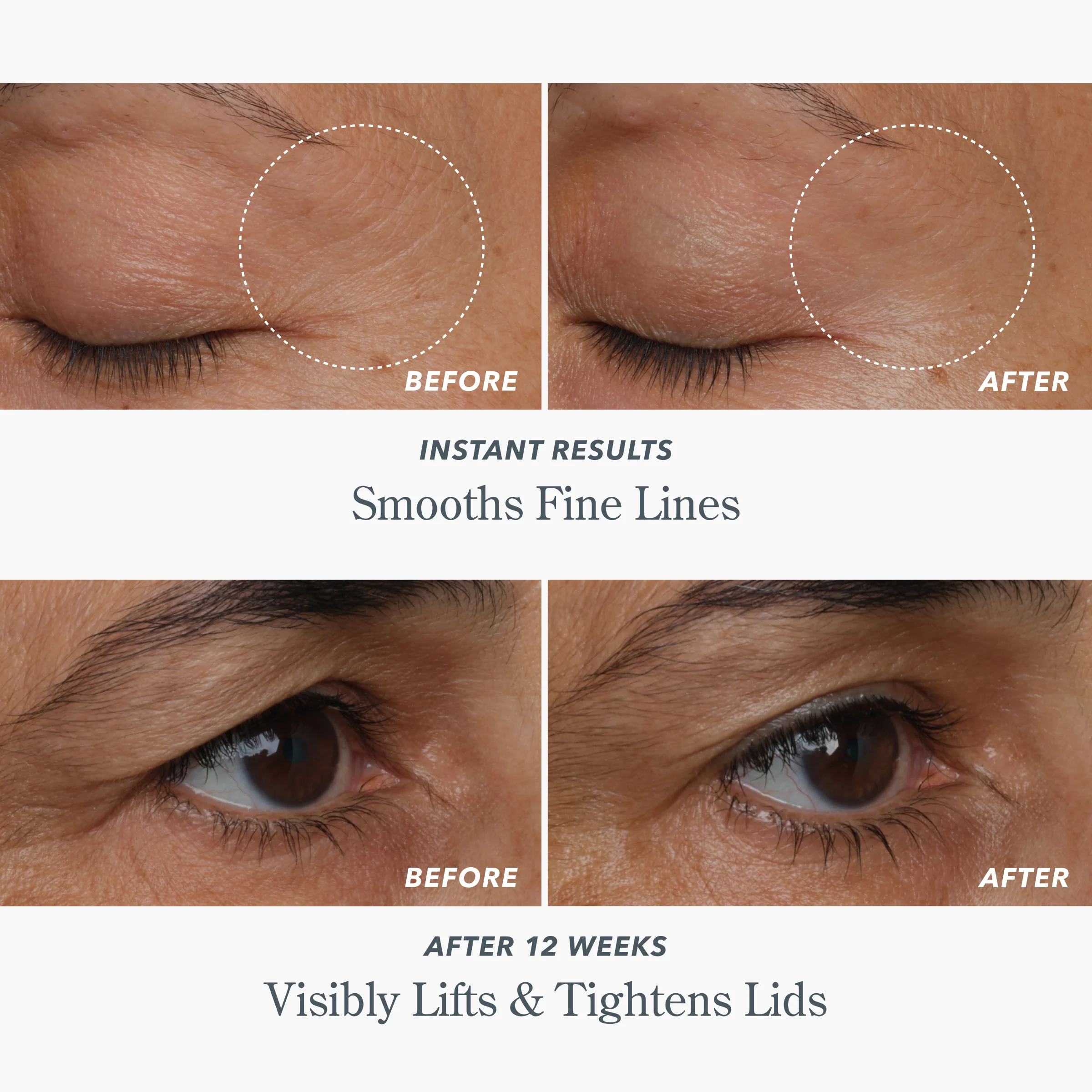 Milk RX Advanced Better Aging Dual Eye Treatments - Image 4