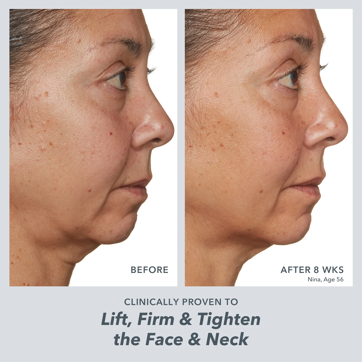 Supercharged Skincare Routine - Image 12