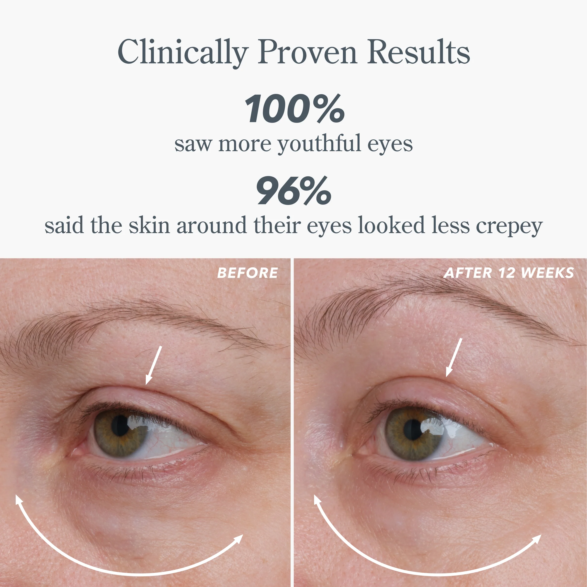 Milk RX Advanced Better Aging Dual Eye Treatments - Image 3