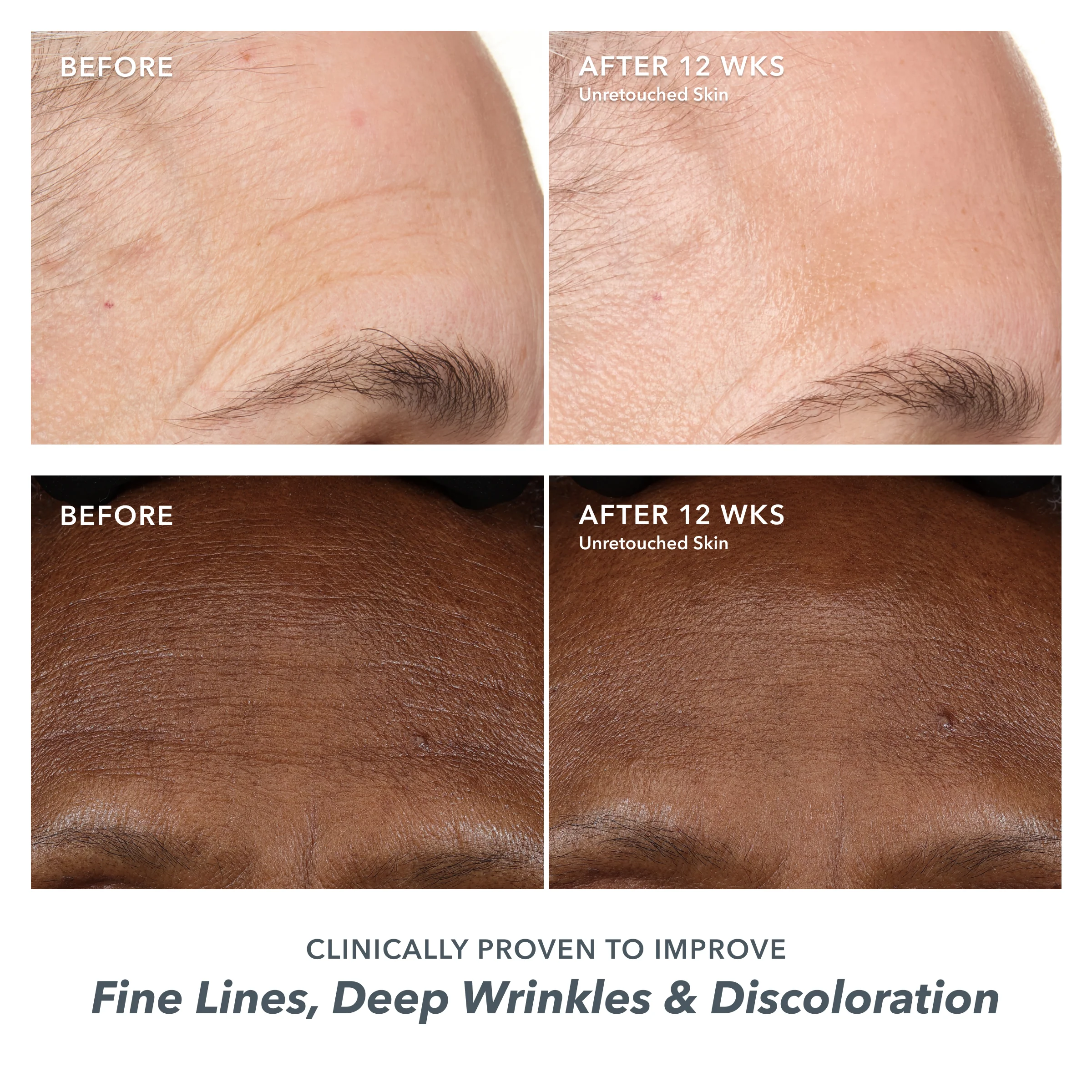 Supercharged Skincare Routine - Image 3
