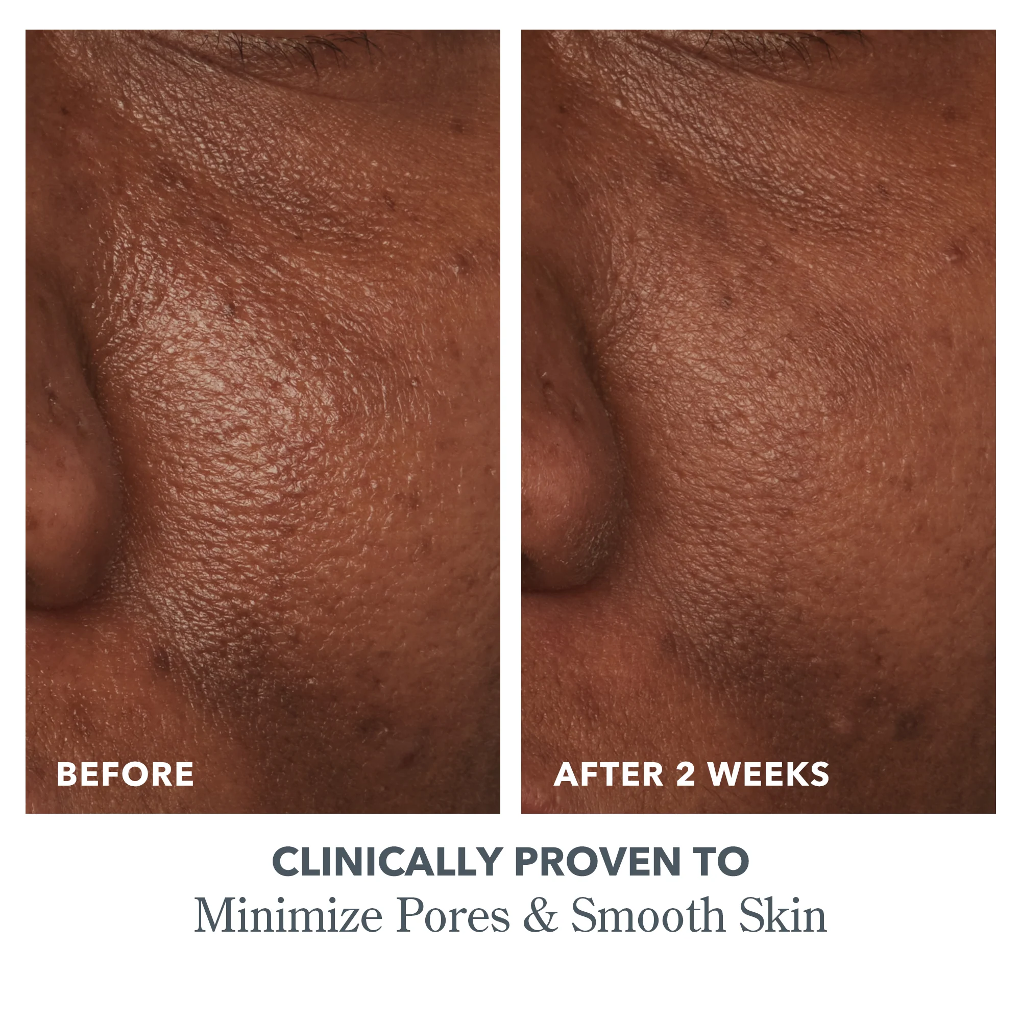 Petal Soft Skin Routine - Image 5