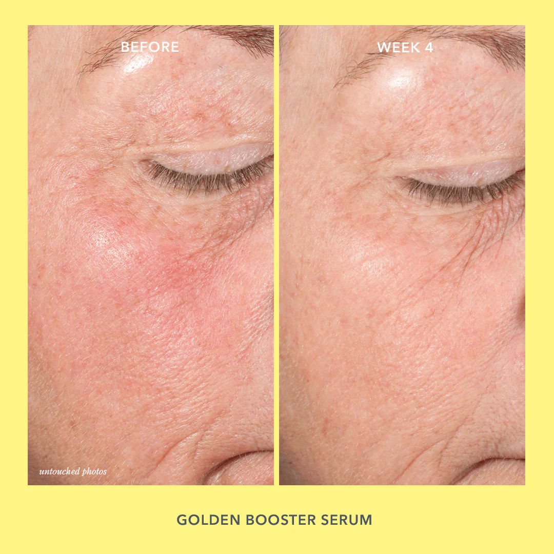 Your Healthiest Skin Ever Skincare Bestsellers Set - Image 9